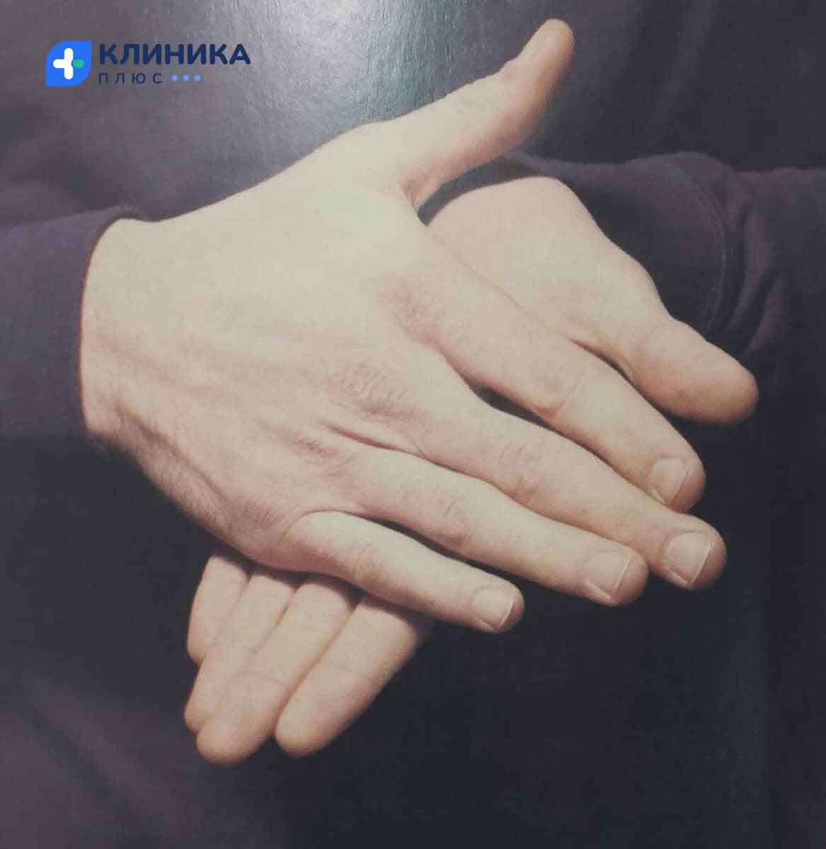 Потирание рук друг об друга